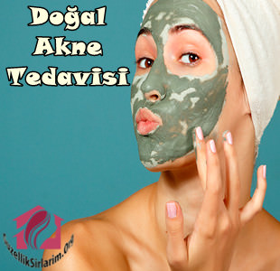 Doğal Akne Tedavisi İçin Bitkisel Kürler