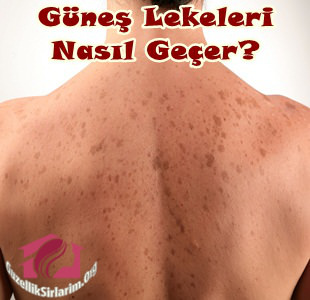 Güneş Lekeleri Nasıl Geçer Diyenlere 4 Doğal Maske