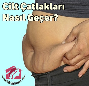 Cilt Çatlakları Nasıl Geçer? Doğal ve Bitkisel Çözümler Nelerdir?