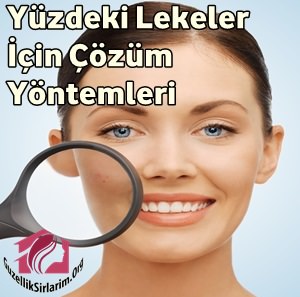 Yüzdeki Lekeler Nasıl Geçer?