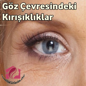 Göz Çevresi Kırışıklıkları Nasıl Geçer?