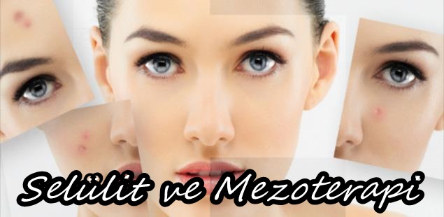 Selüliti Geçiren, Selüliti Gideren İğnesiz Mezoterapi