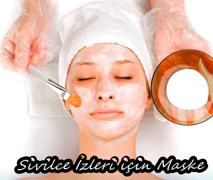 Etkili Sivilce Kürleri: Sivilceleri Geçiren, Sivilce Söndüren Maske Tarifleri