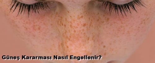 Güneş Kararması Nasıl Geçer