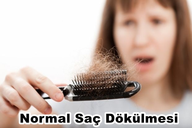 Kadınlarda Saç Dökülmesi ve Nedenleri