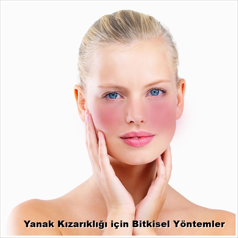 Yüz Kızarıklığına Bitkisel Çözüm