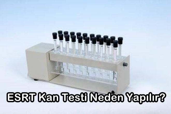 Sedimantasyon Nedir? (Sedimantasyon Yüksekliği, Düşüklüğü ve Tedavisi)