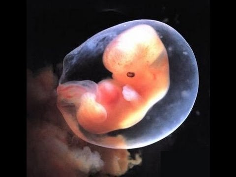 6 Haftalık Gebelik Kesesi Ultrason Görüntüsü